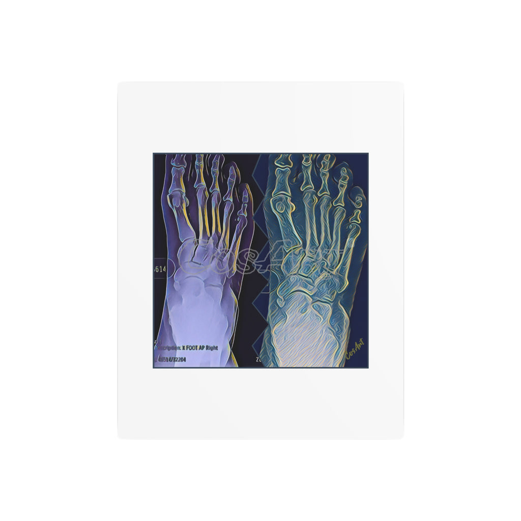 Metal Art Sign - X-Ray Foot Bones Abstract Medical Wall Decor