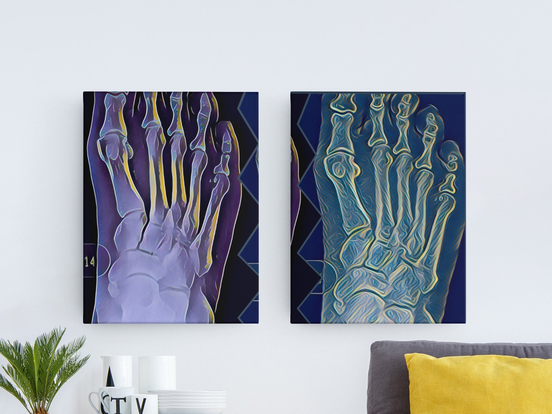 Anatomical Foot X-Ray Metal Art Sign (Green) — Medical Decor for Podiatrists & Anatomy Lovers