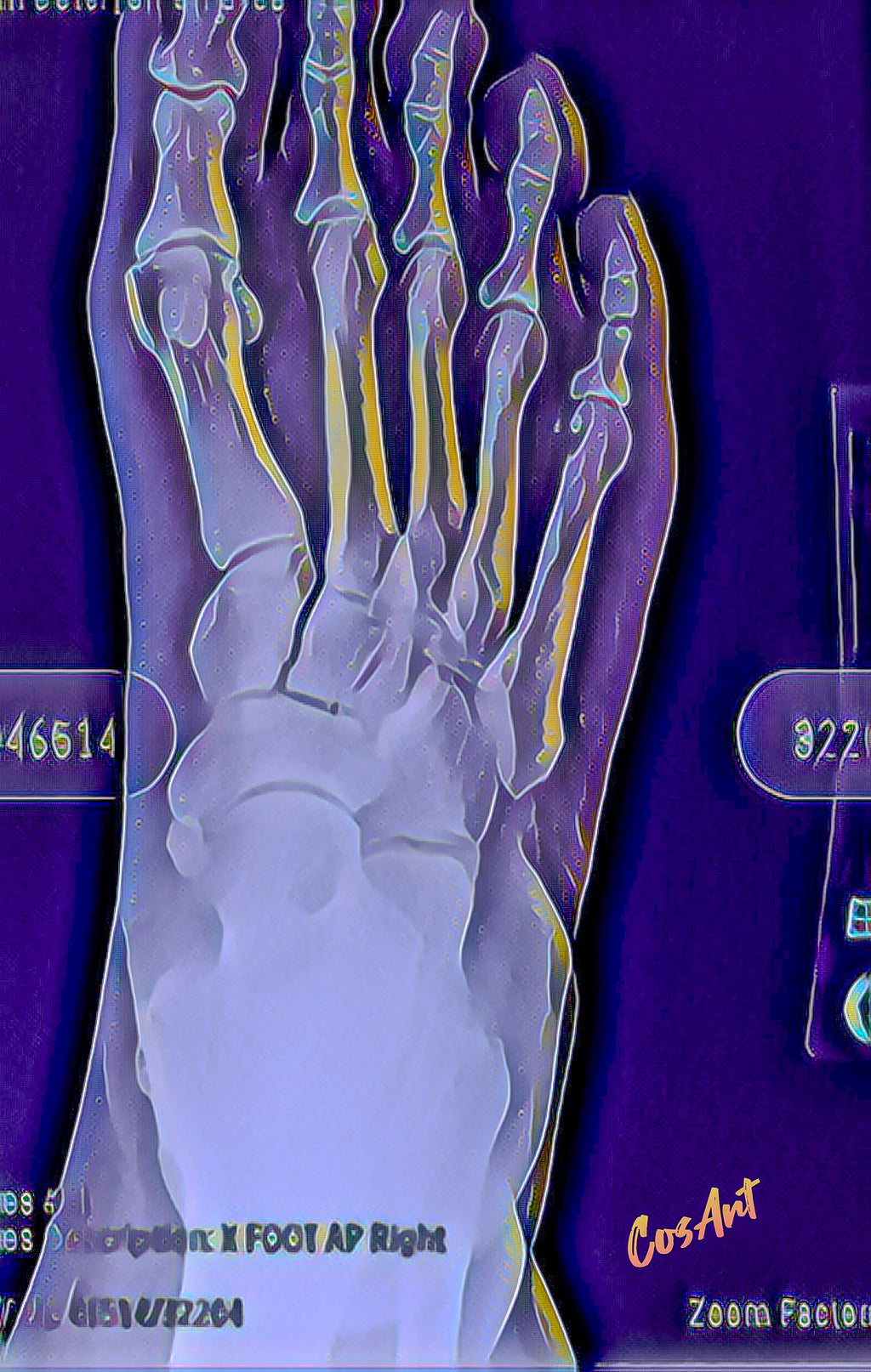 Anatomical Foot X-Ray Metal Art Sign (Green) — Medical Decor for Podiatrists & Anatomy Lovers