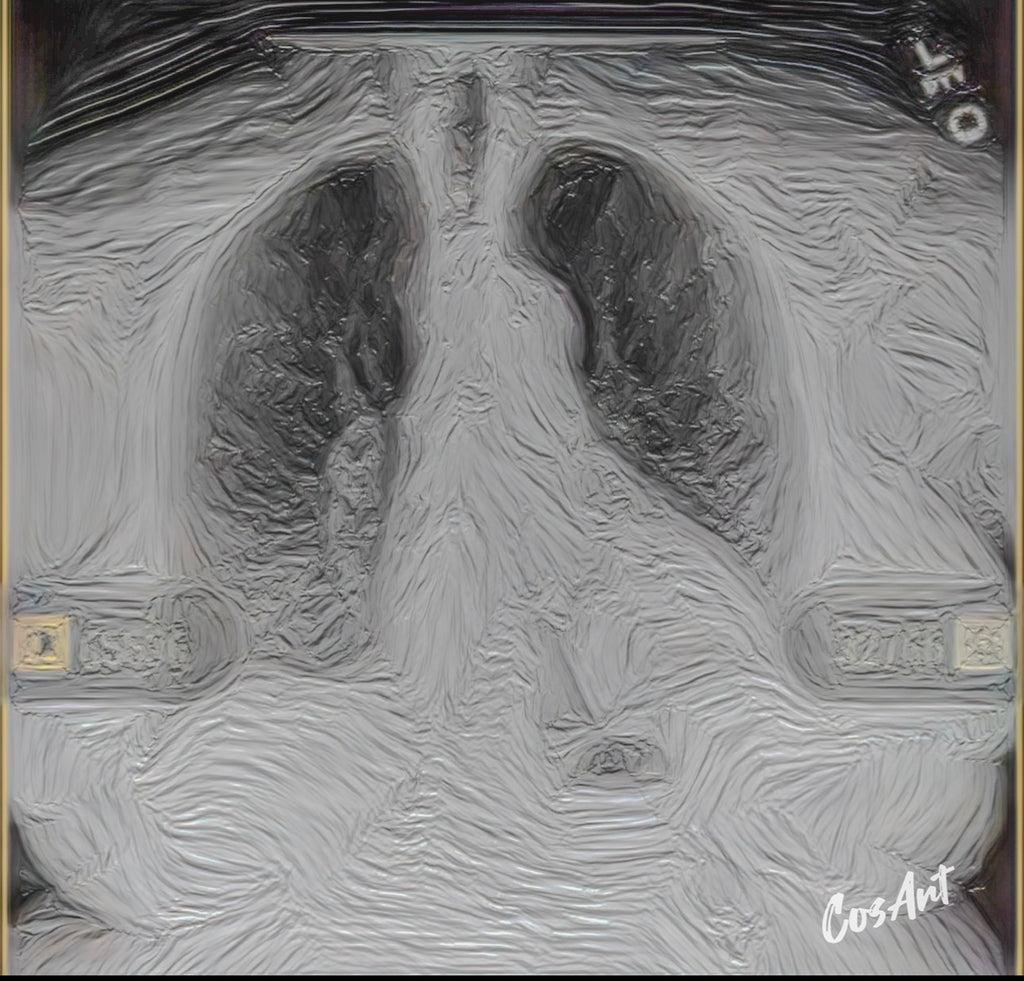 Metal Art Sign - X-Pressions X-Ray Lungs Wall Decor (Medical Anatomy Artwork)