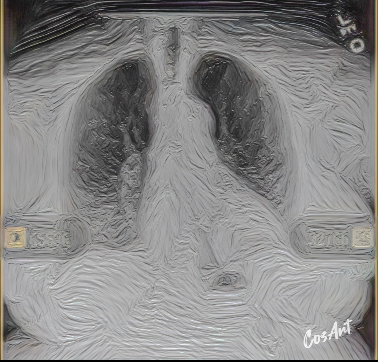 Metal Art Sign - X-Pressions X-Ray Lungs Wall Decor (Medical Anatomy Artwork)