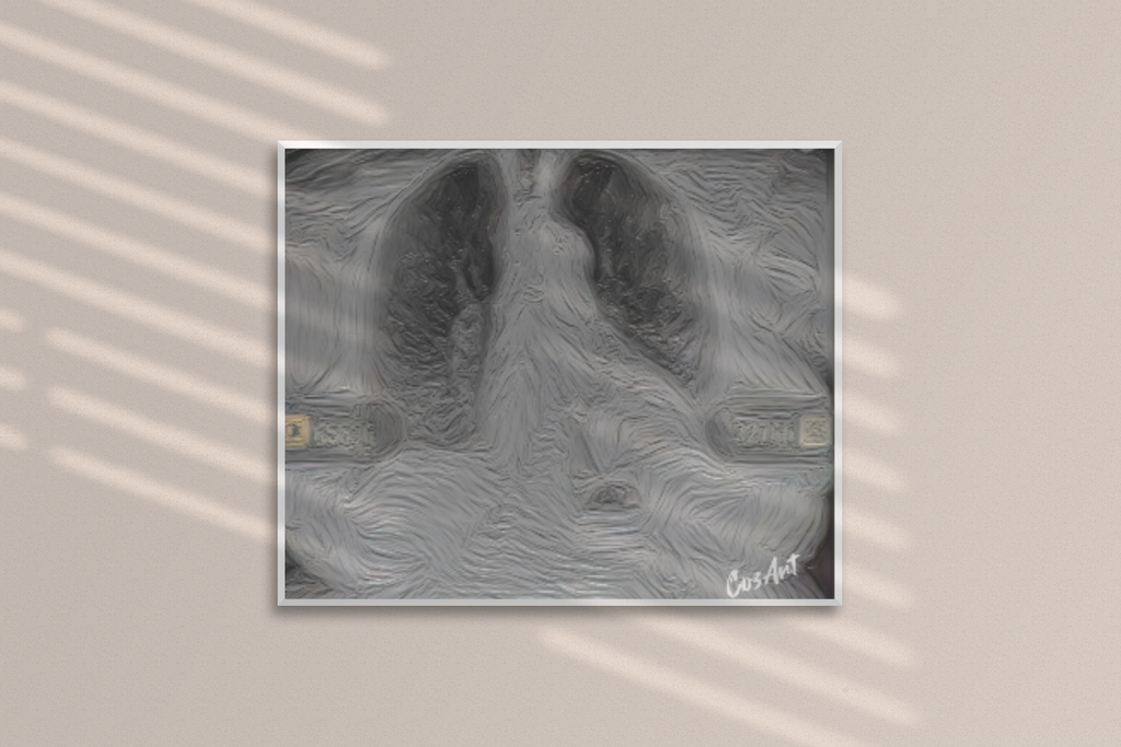 Metal Art Sign - X-Pressions X-Ray Lungs Wall Decor (Medical Anatomy Artwork)