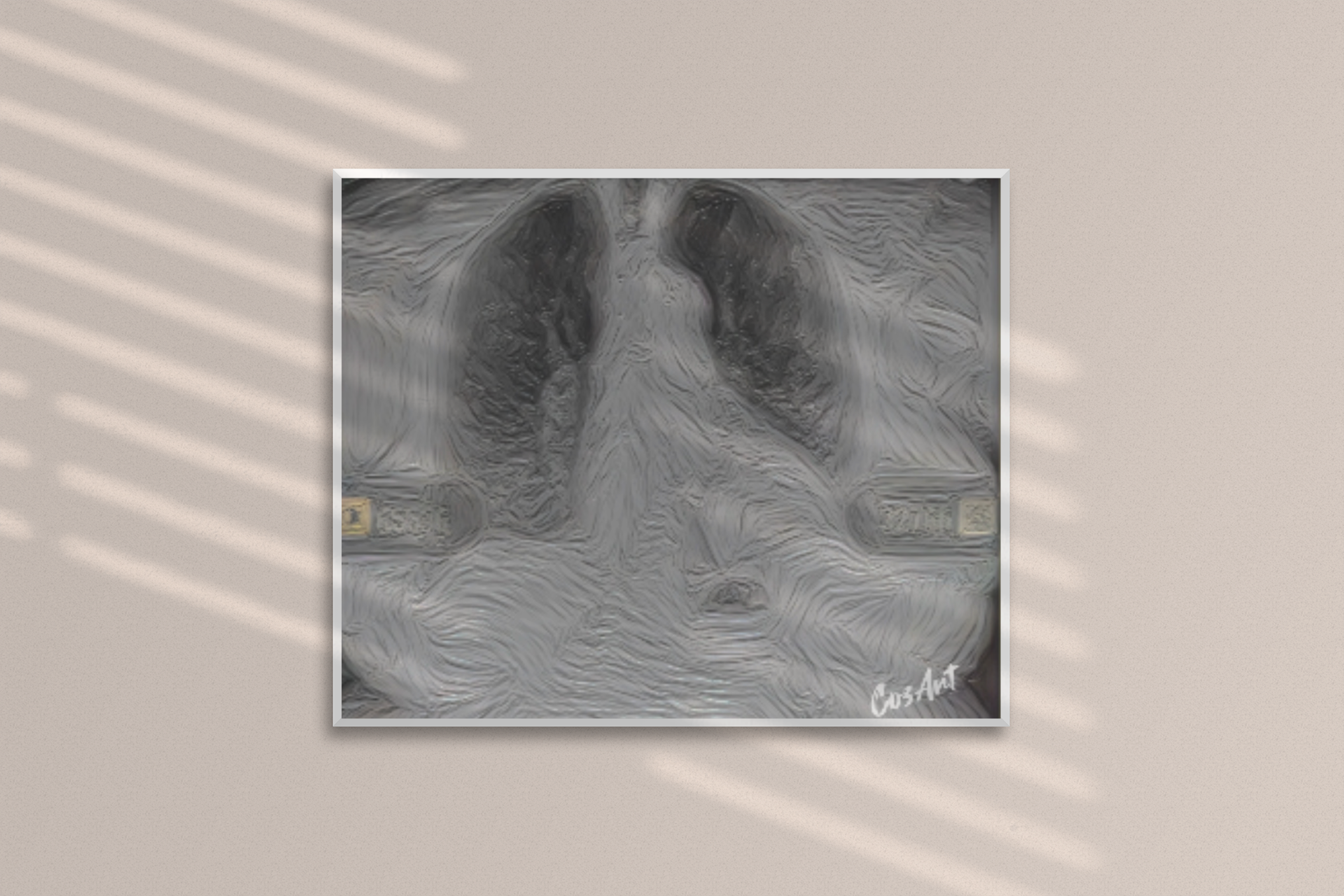 Metal Art Sign - X-Pressions X-Ray Lungs Wall Decor (Medical Anatomy Artwork)
