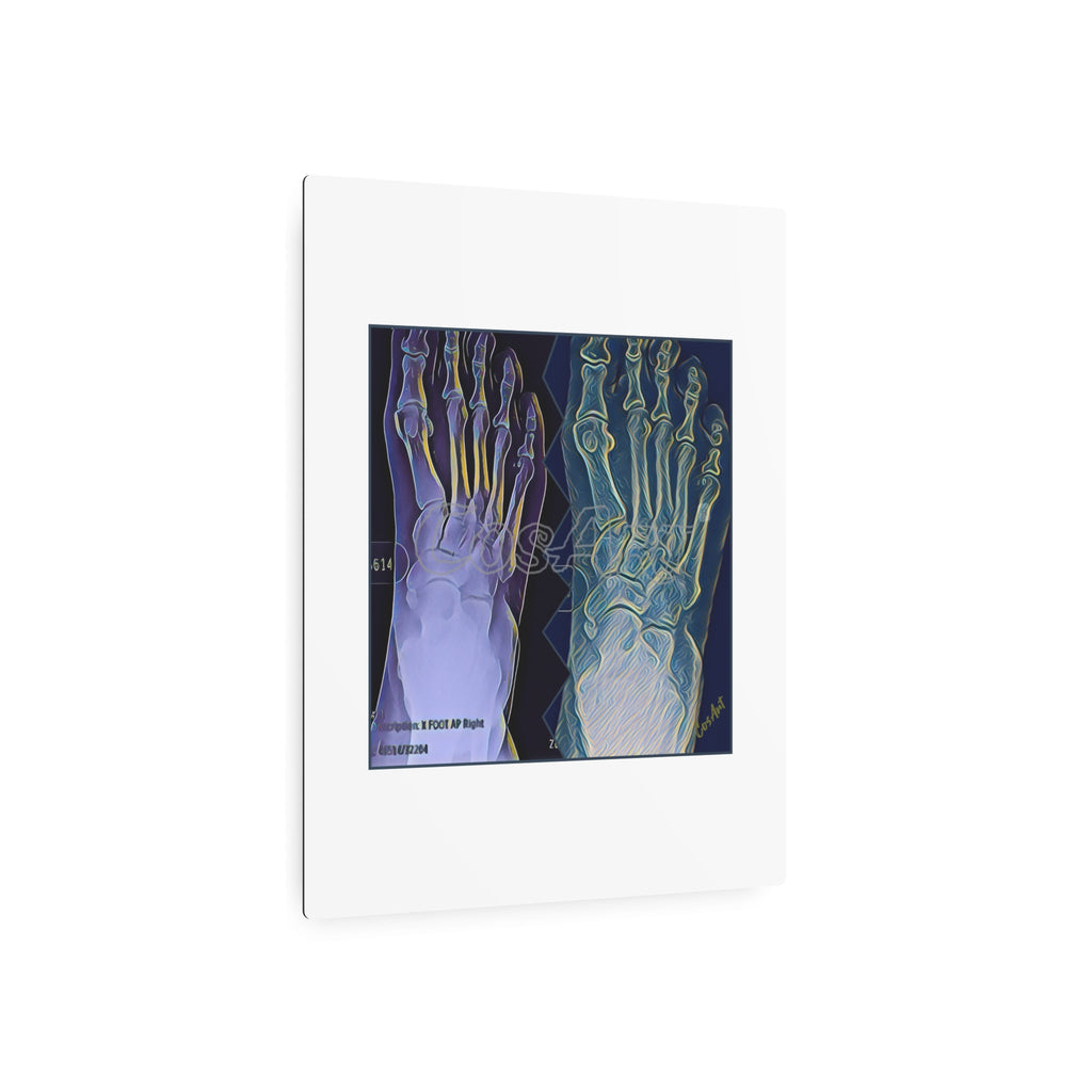 Metal Art Sign - X-Ray Foot Bones Abstract Medical Wall Decor