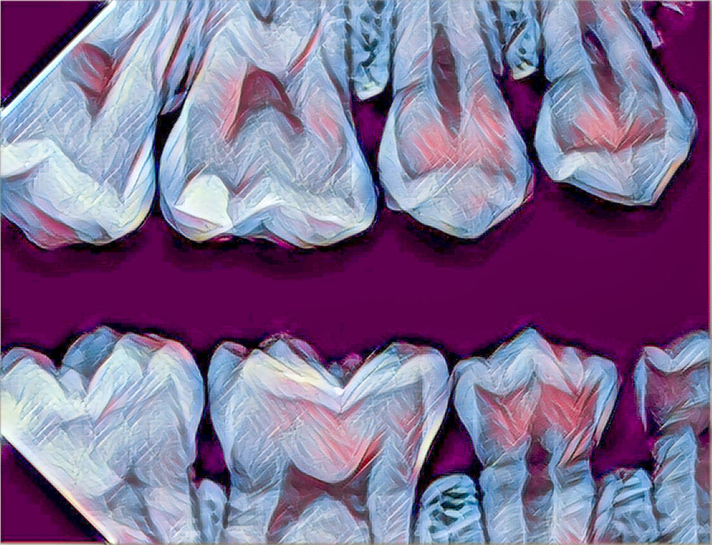 Bitewing X-ray Mousepad Purple