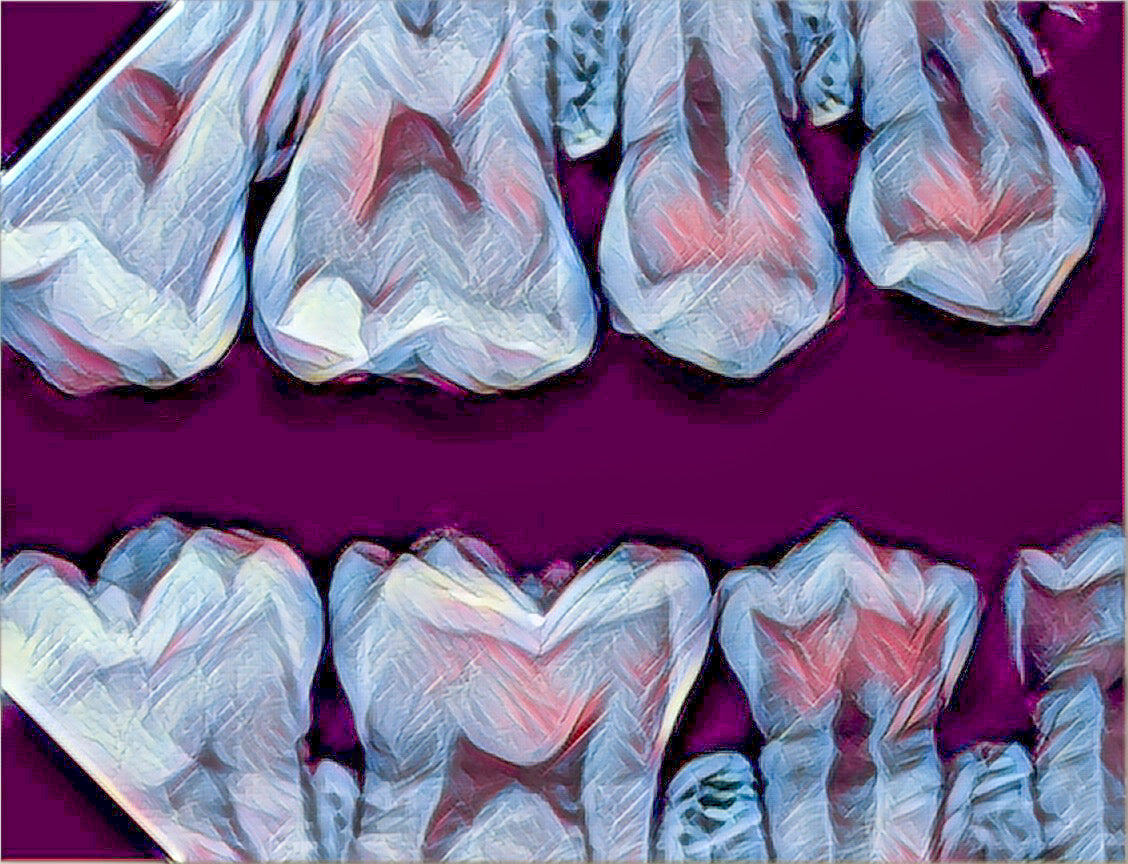 Bitewing X-ray Mousepad Purple